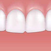 Misshapen teeth